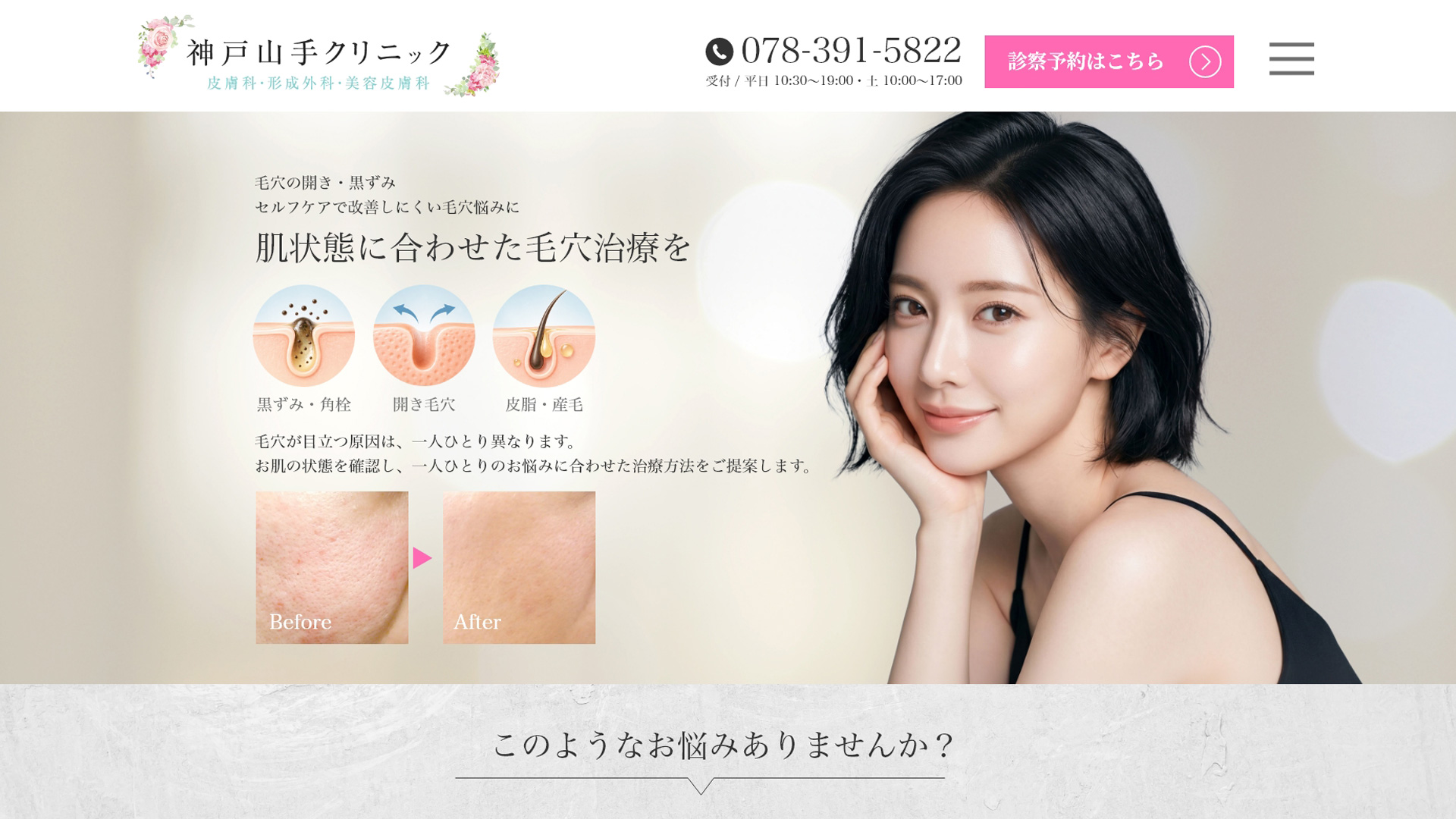 美容皮膚科クリニックの毛穴治療のLPの制作実績